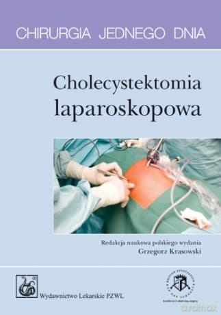 Chirurgia jednego dnia - Cholecystektomia laparoskopowa - McWhinnie
