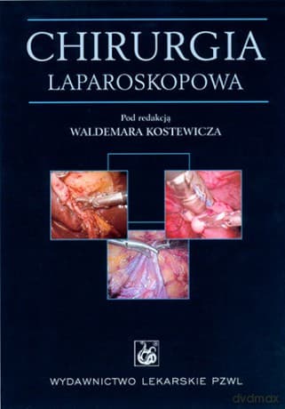 Chirurgia laparoskopowa - Kostewicz