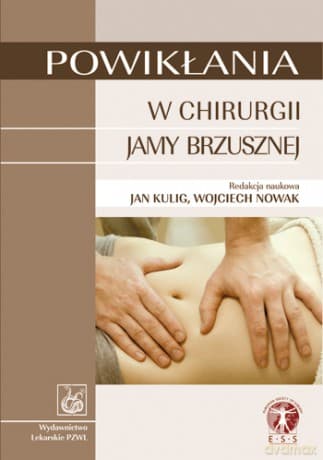 Powikłania w chirurgii jamy brzusznej - Kulig