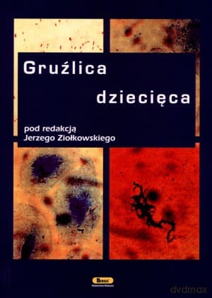 Gruźlica dziecięca - Jerzy Ziołkowski (red.)