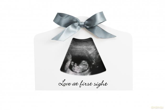 Dooky - Happy Hands Sonogram Echo Frame - White - 20 x 15 cm